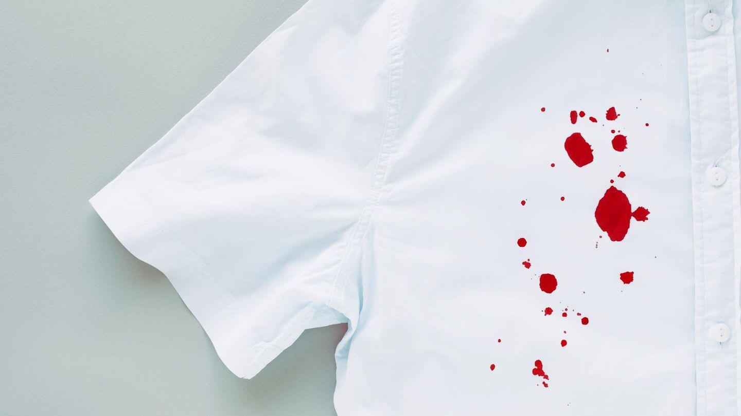 Blutflecken: Fleckenhilfe: Blutflecken entfernen: So verschwinden hartnäckige Spuren