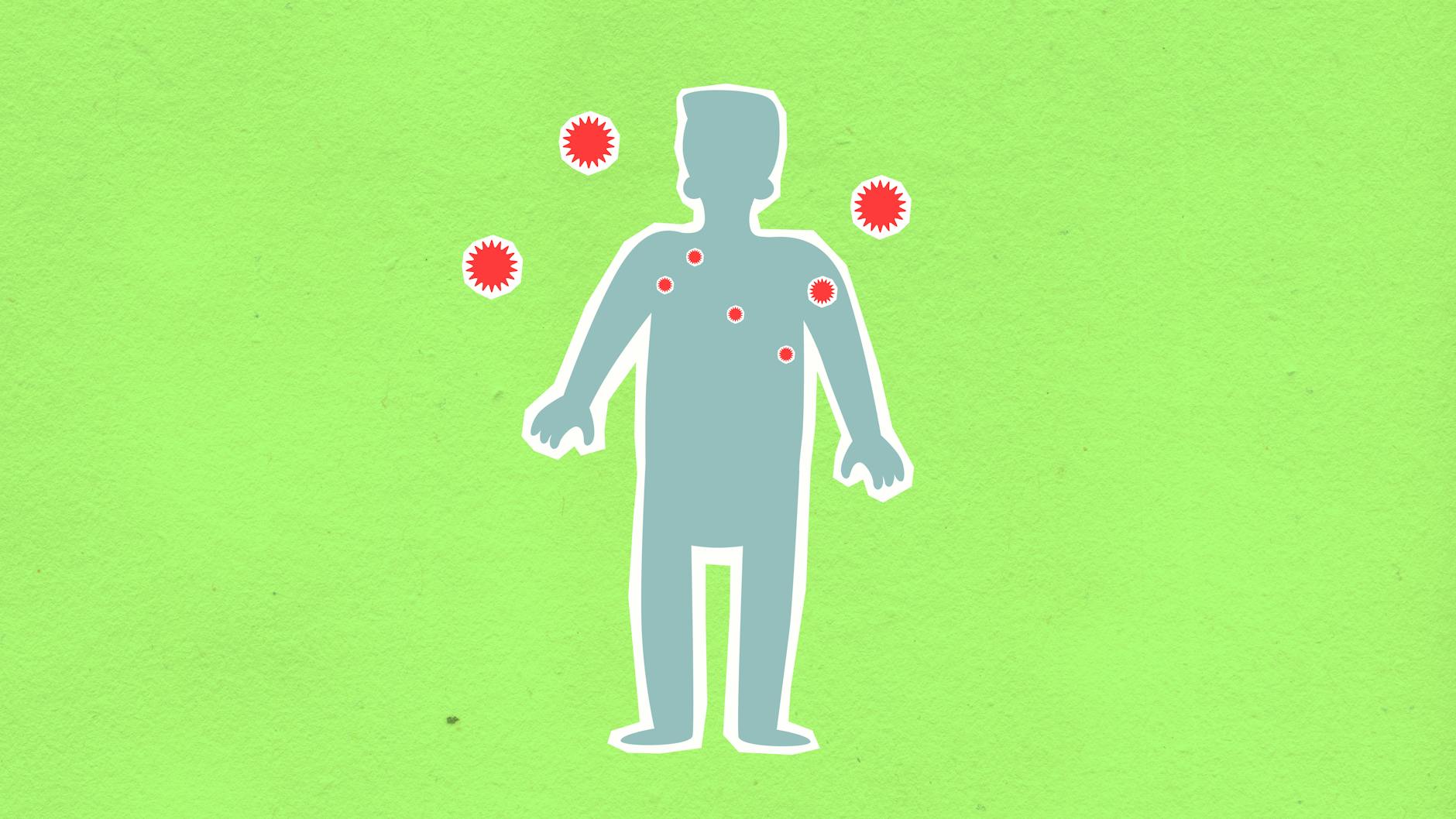 Hepatitis A Kampanien Detailansicht: Hepatitis A Kampanien